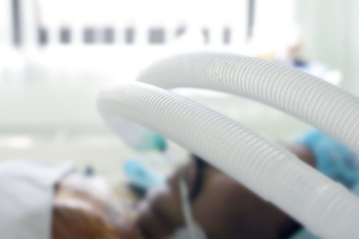 Increased respiratory secretions during surgery