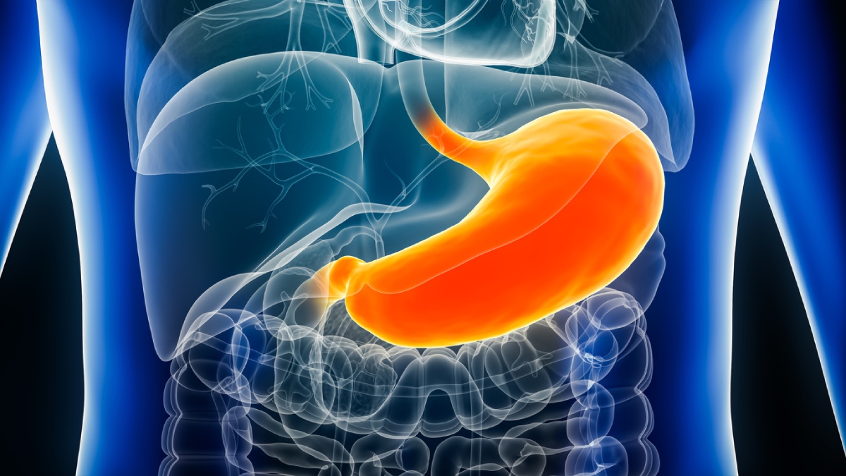 Gastric Emptying in Patients Taking GLP-1s